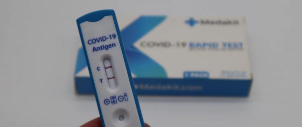 El Sector insiste en la necesidad de aplicar test de antígenos frente a los PCR